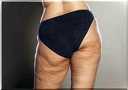 Do you know how to fight cellulite?